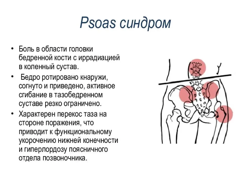 От чего болят тазобедренные суставы у женщин
