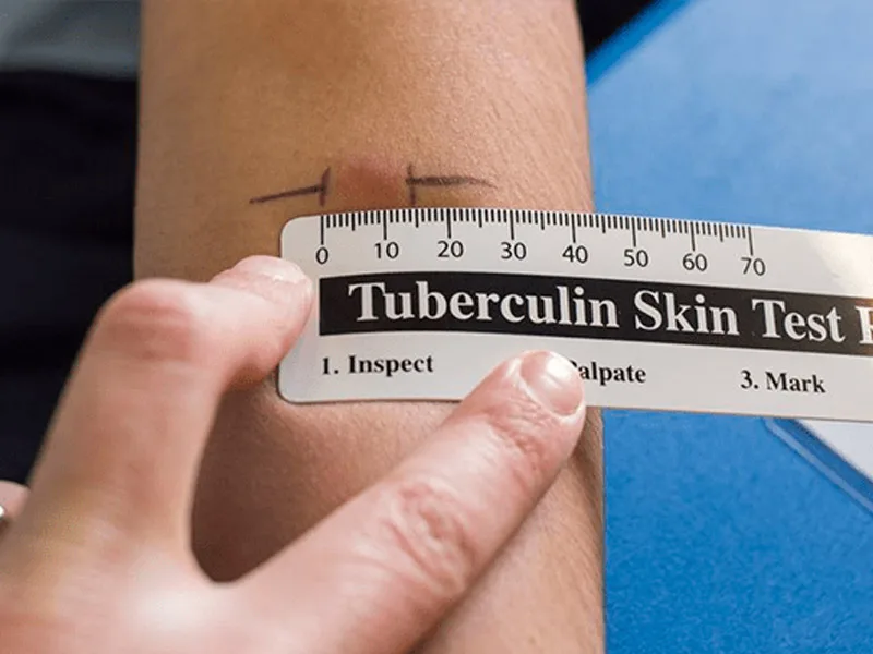 все фото - яндекс-картинки