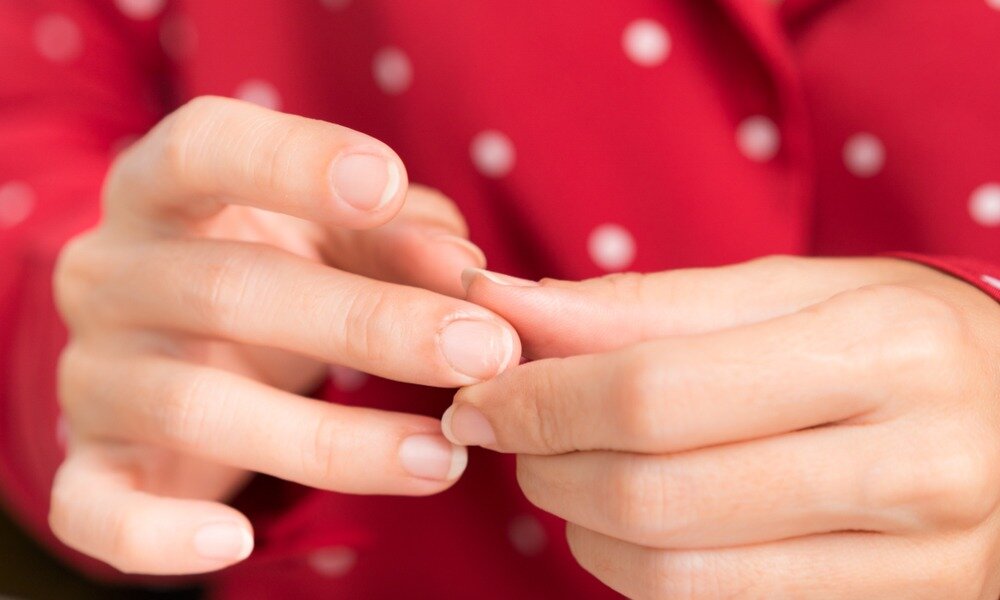 Белые пятна на ногтях - причины, каких витаминов не хватает, лечение