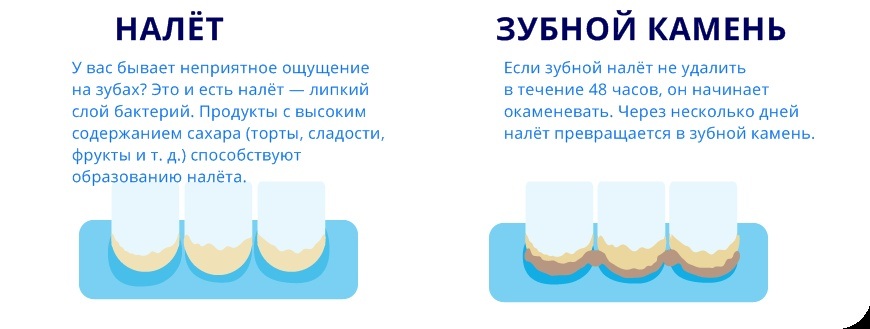 Как снять зубной налет, избавиться от желтизны и коричневого налета на зубах?