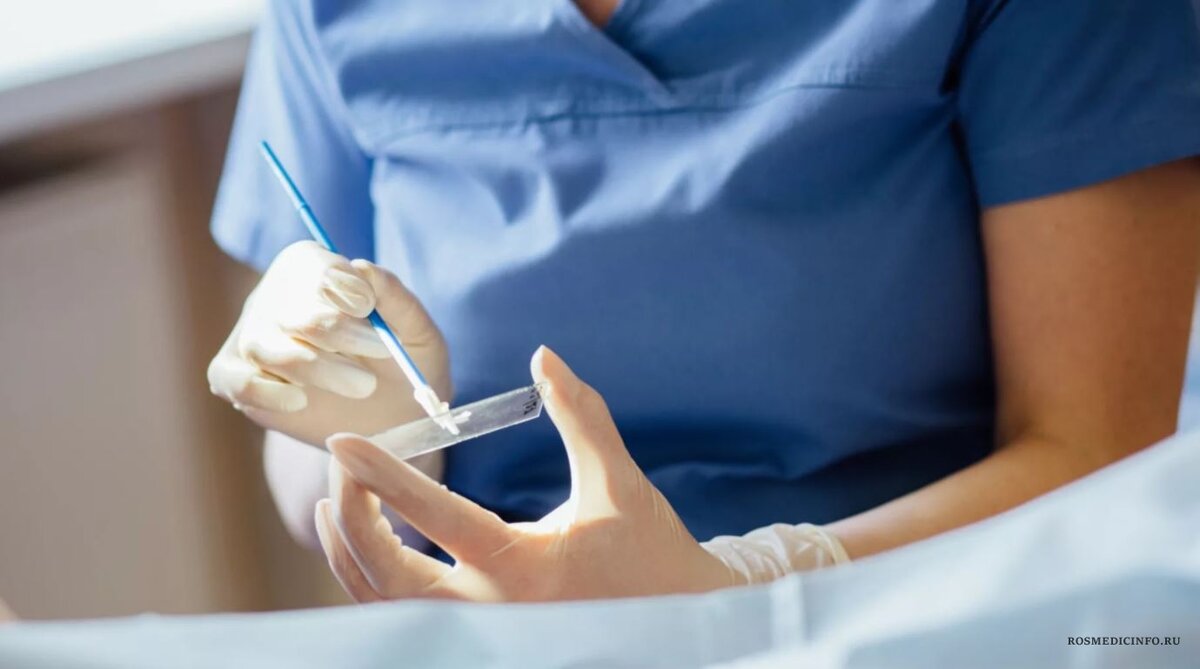 Мазок на онкоцитологию - ранний метод диагностики рака