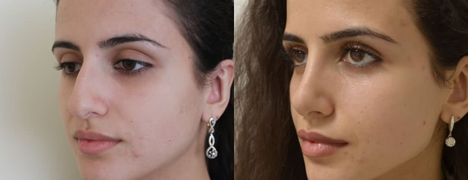 Фото с сайта хирурга Гришкяна Д.Р.