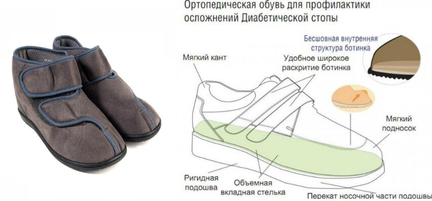 Обувь, для профилактики синдрома диабетической стопы