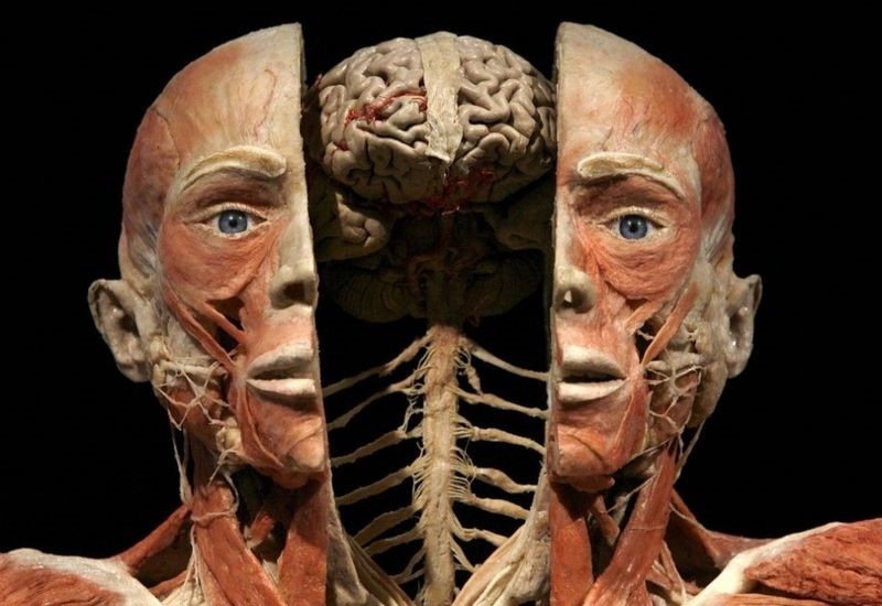 Пластинированное тело