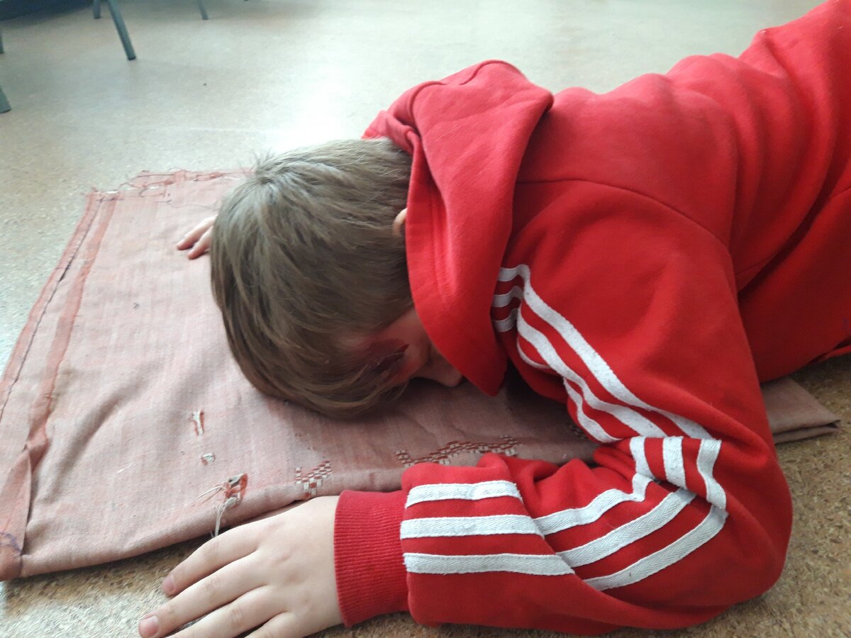 Ушиб на голове мальчика кажется жутким. К счастью, это всего лишь грим.