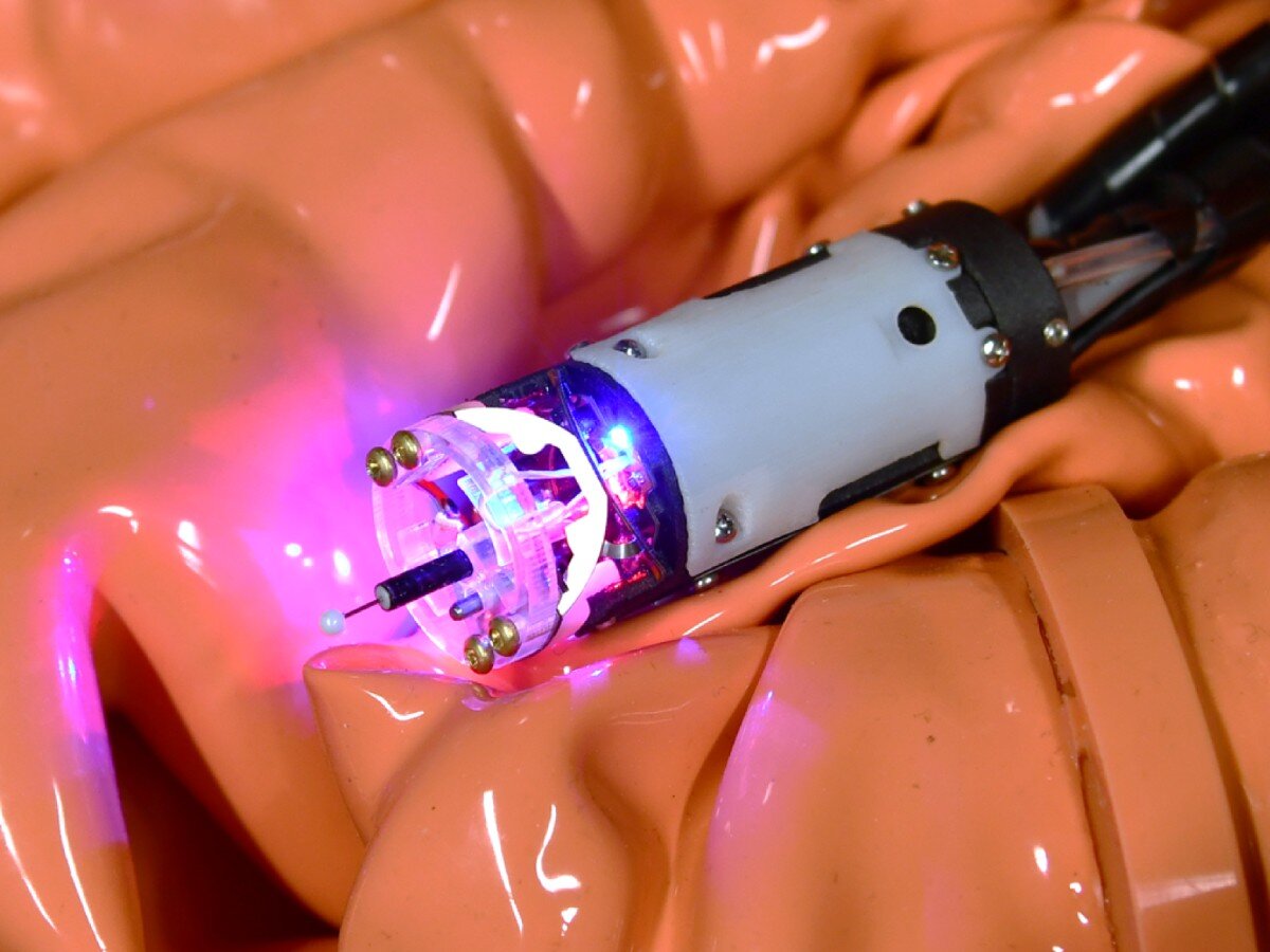    Робот-щупальце совершит прорыв в скрининге рака кишечника