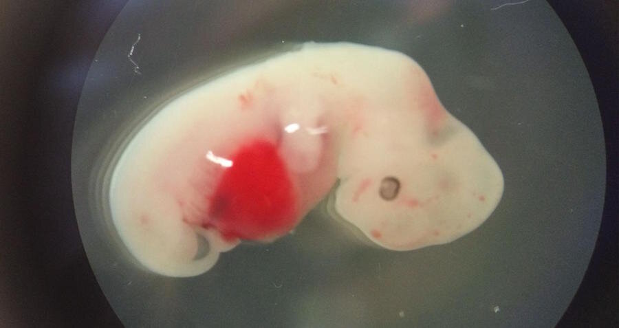 Этому эмбриону свиньи вводили клетки человека на ранних этапах его развития, и он достиг возраста четырех недель.