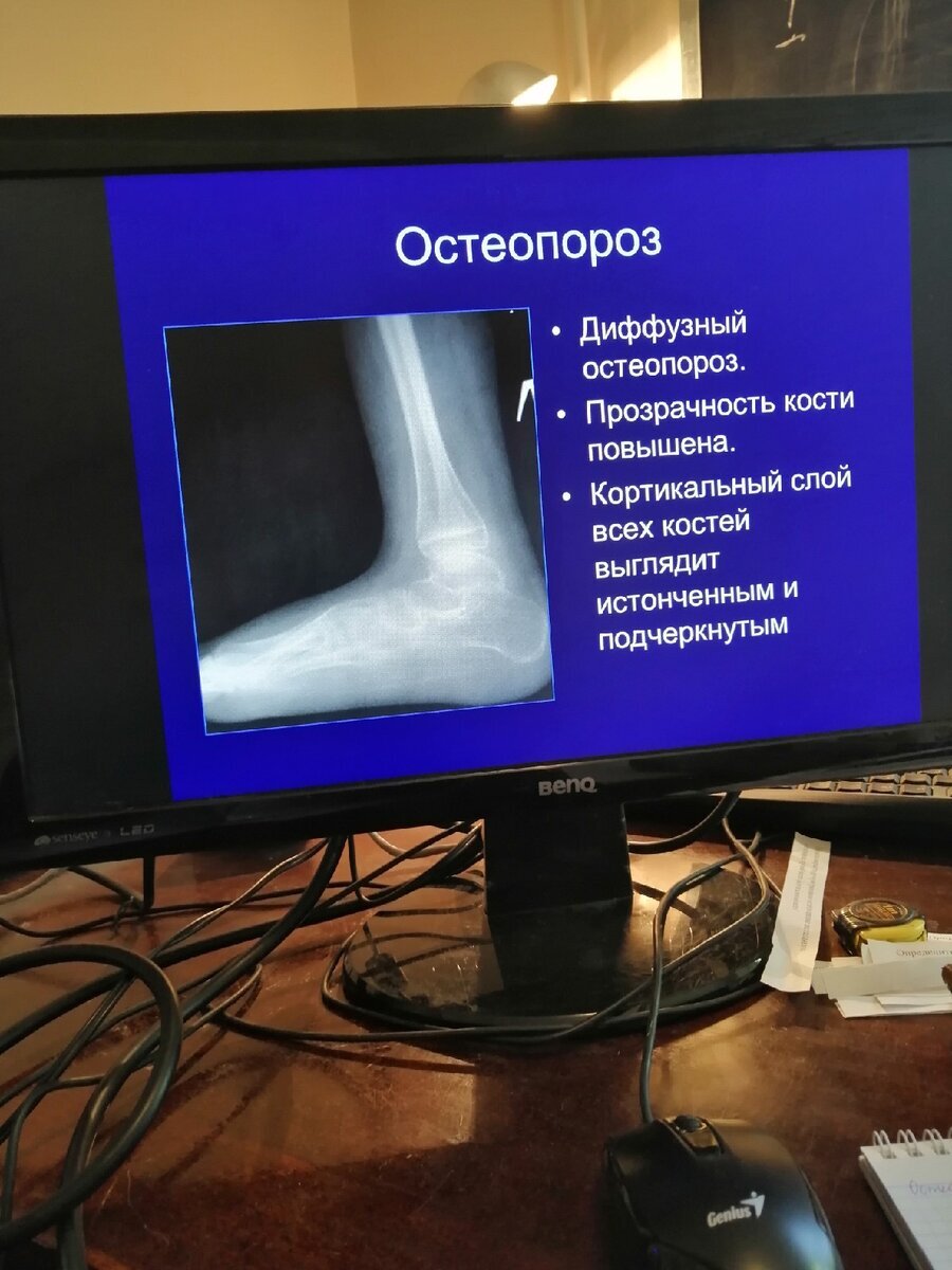 А ещё тут очень понадобятся знания рентгенологии. Прямо ОЧЕНЬ понадобятся, серьёзно