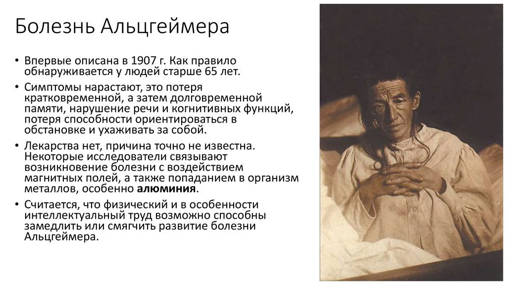 Айцгемерова болезнь признаки симптомы у женщин фото