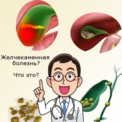 Доктор голод невролог. Желчнокаменная болезнь. Печень врач. Диета при желчнокаменной болезни и камнях в желчном пузыре. Канал печени и желчного пузыря.