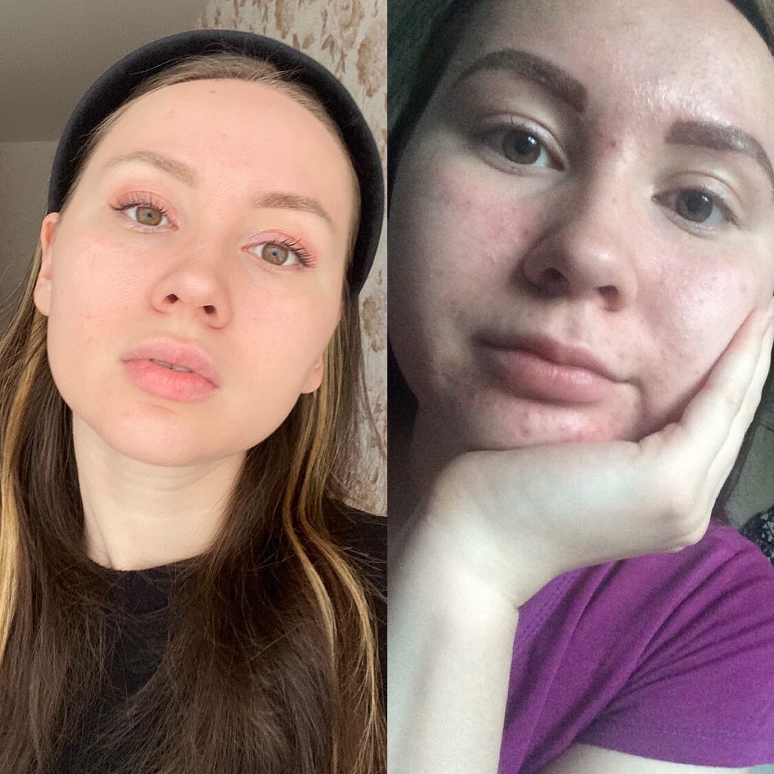 Разница в 4 года. Оба фото без обработки