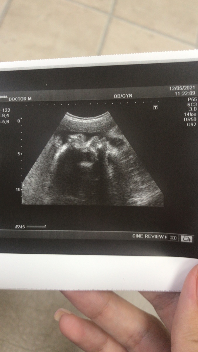 Фото малыша на 30 недели 