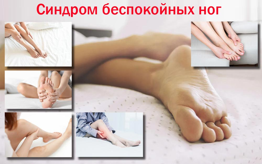 Синдром беспокойных ног лечение у женщин. Синдром беспокойных ног клиника. Синдром беспокойных ног массаж.