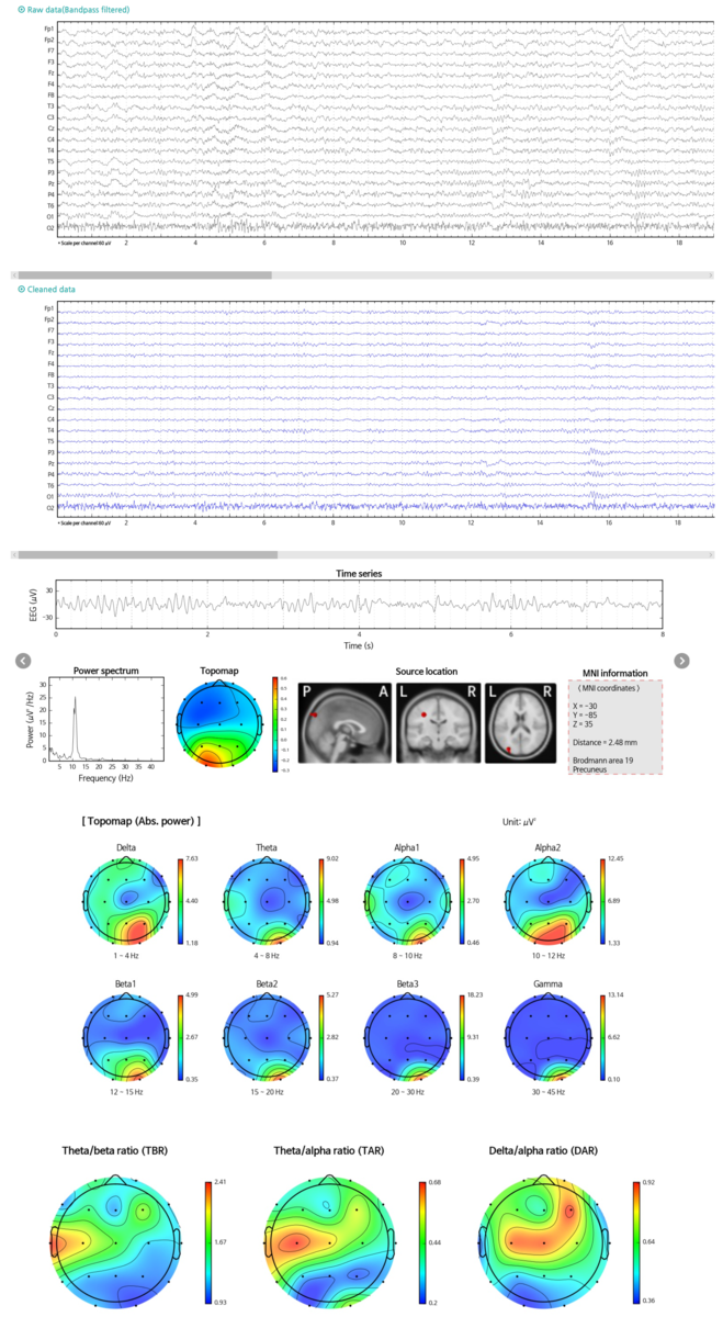 Результат анализа системы iSyncBrain