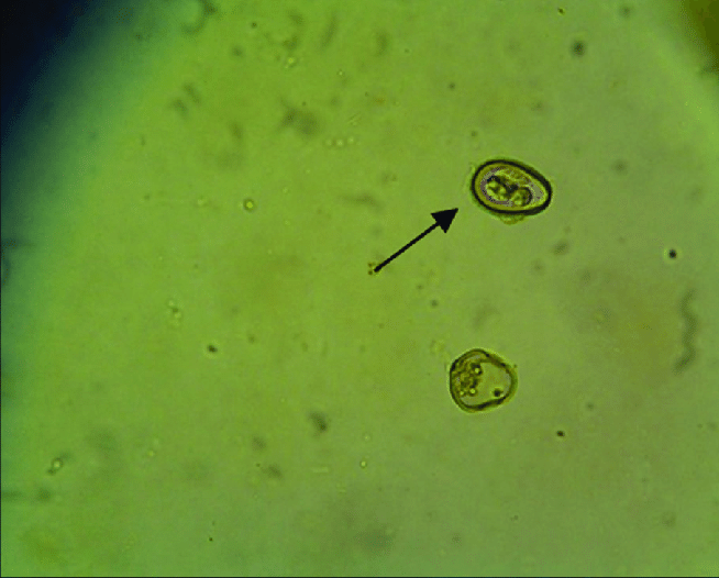 Blastocystis spp. Фото: researchgate.net 