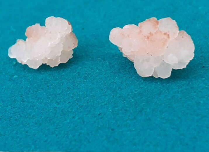 Каллус чая. Фотография сделана автором в НИИ физиологии растений им. К.А. Тимирязева