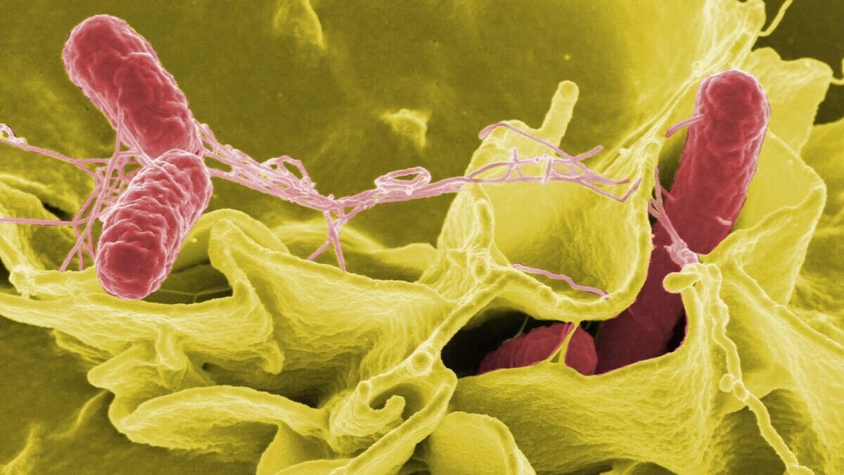    Раскрашенное изображение клеток Salmonella typhimurium (красные) в культуре клеток человекаCC0 / NIAID /