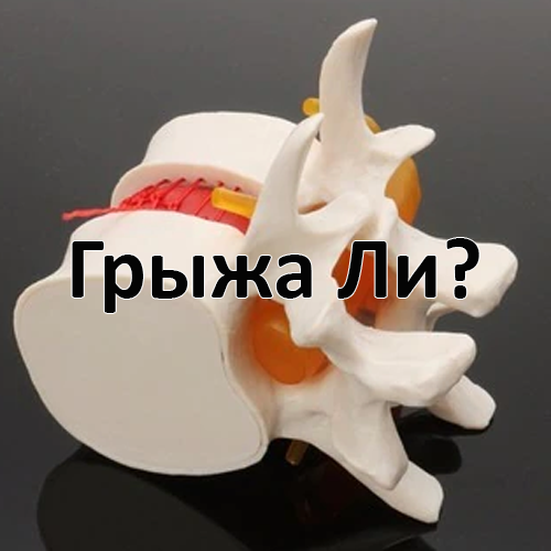 Грыжа или не грыжа? Возможна протрузия - начало грыжи.