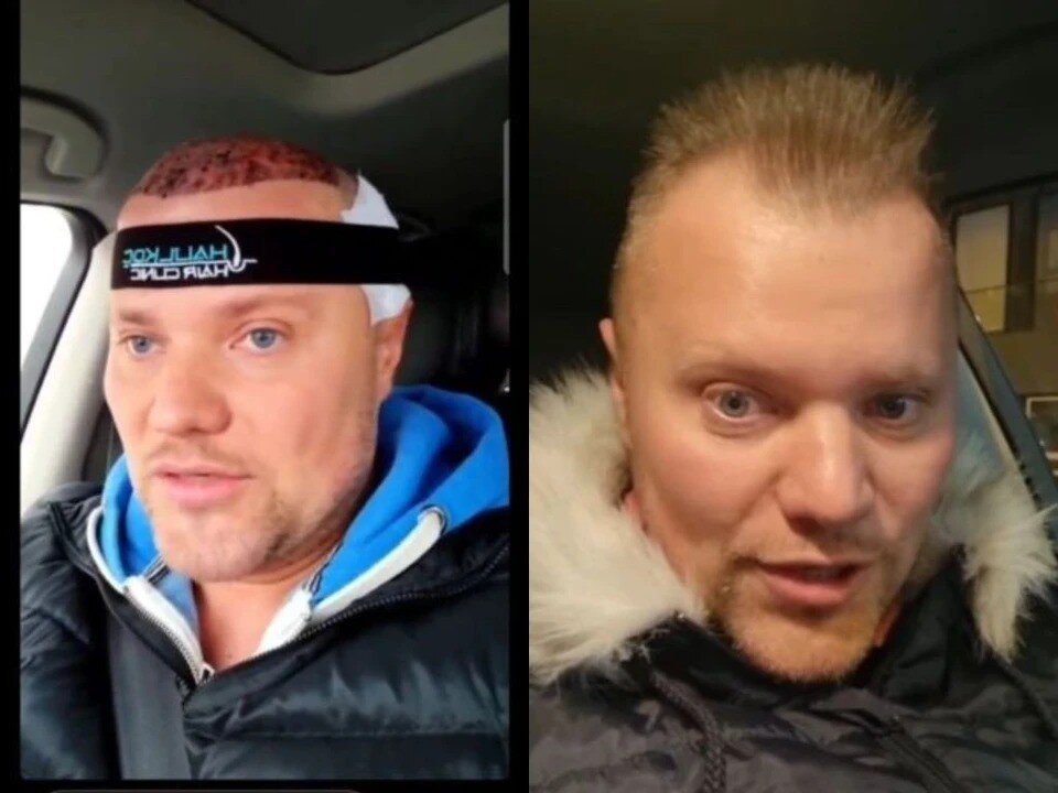     Певец иногда показывался в соцсети без головного убора. Фото: соцсети.