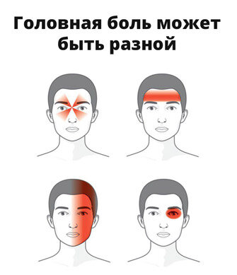 Заклинило шею, больно поворачивать: что делать в домашних условиях?