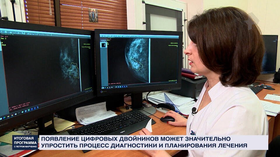    Цифровые двойники и роботы: искусственный интеллект меняет медицину