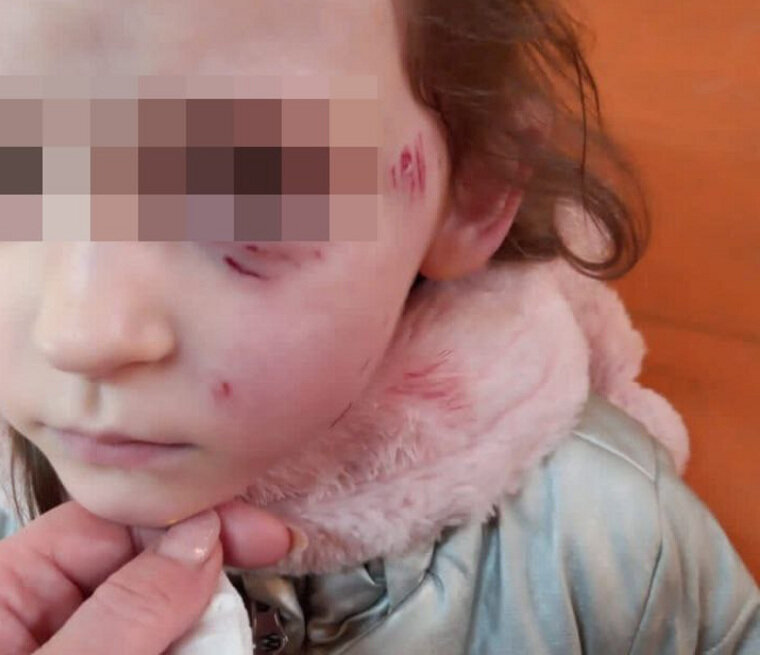    Малышка была напугана до слез
