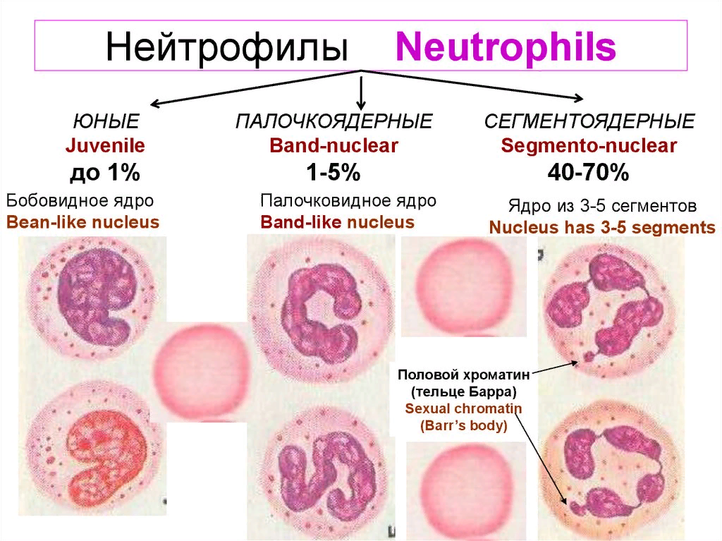 Нейтрофилез. Палочкоядерные нейтрофилы 1 у взрослого. Нейтрофилы юные палочкоядерные сегментоядерные. Сегментоядерные гранулоциты функции. Функции сегментоядерных нейтрофилов.