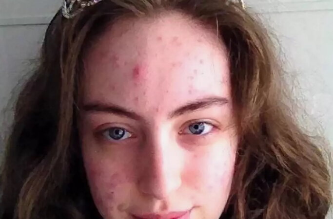 Фото взято из открытых интернет-источников. К слову, у меня похожая ситуация 