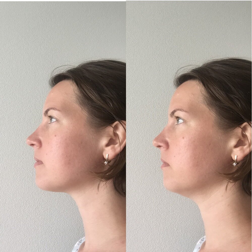 Слева поднят к верхнему небу, справа язык опущен вниз. Разница колоссальная.