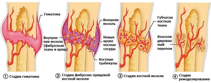 Лечение повреждений мышц, связок, сухожилий