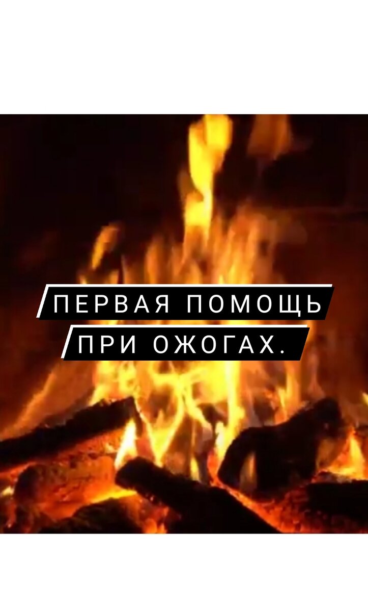 При ⚠️ТЕРМИЧЕСКОМ ожоге(высокой температурой), необходимо убрать источник ожога(если горит человек, набросить вещи, тем самым, предотвращая доступ кислорода, огонь потухнет, бензин и другие нефтепродукты тушить только так, от воды сильнее загорятся, так как они легче неё. Нефтепродукты можно засыпа'ть песком и землёй). После этого на место ожога лить в течение 20 минут холодную воду, либо приложить в целлофане снег или лёд. Далее присыпать питьевой содой. Если поражение большое, полить мирамистином или фурациллином(1 таблетку измельчить и растворить в стакане кипятка, остудить), закрыть стерильной повязкой и доставить пострадавшего в ожоговый центр, где при больших процентах поражения кожи, её восстановят искусственной кожей. Никаких жиров и мазей в первый день не наносить!!! Обращаться за медицинской помощью необходимо уже при 1% поражения (площадь приблизительно измеряется 1 ладони самого пострадавшего человека). При 20%(20 ладоней) поражения ожог может быть смертельным. Играет роль глубина поражения тканей.Если площадь поражения небольшая и вы лечитесь дома, но глубина поражения тканей большая, обязательно прикладывать марлю в 8 слоёв пропитанную раствором ФУРАЦИЛЛИНА. Между прикладываниями наносим на рану пантенол и солкосерил. Вокруг раны наносим противовоспалительное средство, например глюкокортикостироидом Акридерм. Пузыри ни в коем случае не прорывать, не прокалывать, не срезать,иначе будет сильная боль в течение недели и более, такая, что не сможете встать на ноги, если это стопа. При ХИМИЧЕСКОМ ожоге, кислоты нейтрализуются слабыми растворами щелочей, а щелочи слабыми растворами кислот. Для этого, например уксусную ⚠️КИСЛОТУ нейтрализуем раствором соды (1 чайная ложка на стакан воды, полить на кожу или выпить, если кислота в желудке).Либо используем мыльный раствор. Если выпили или попала на кожу ⚠️ЩЁЛОЧЬ, её нейтрализуем слабым раствором кислоты. Лимонной: 1/2 чайная ложка лимонной кислоты на 5 литров воды, выпить(если щелочь выпили ) или полить на кожу(если ожог кожи). Либо уксусной кислотой: 1% раствор(когда чуть пощипывает кончик языка). Если уксус 70%,то растворяем 1 к 69.То есть, на 1 часть уксуса берём 69 частей воды(в гранёном стакане, не полном, до рубца, 35 чайных ложек воды). Если уксус 9%,то для приготовления 1% раствора на 1часть уксуса  берём 9 частей воды. Получится 1% раствор кислоты, которой мы нейтрализуем любую щёлочь. Ещё больше информации вы получите на моём канале YouTube "Приусадебный участок".Переходите на него по первой ссылке на YouTube, в шапке профиля... 