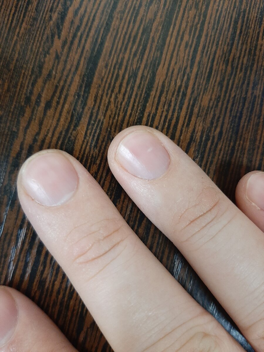 У меня не большое пятнышко