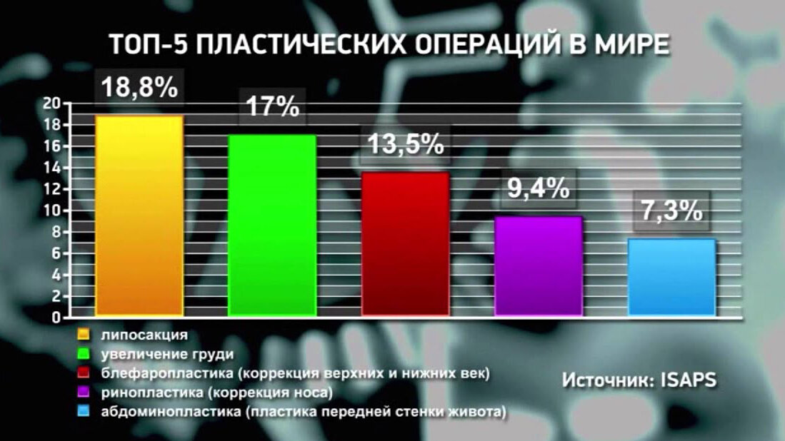 Статистика операции. Статистика пластических операций. Пластическая хирургия статистика. Статистика пластических операций в мире. Статистика пластических операций в мире 2020.