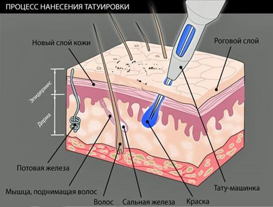 Схематическое изображение процесса внесения пигмента.