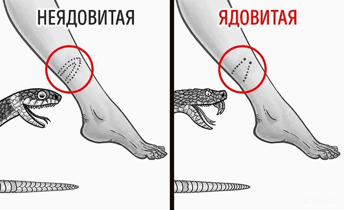 Чуть уж на ногах. Укусы ядовитых и неядовитых змей. Укус ядовитой змеи и неядовитой змеи. Отличие укуса ядовитой и неядовитой змеи. Как отличить укус ядовитой и неядовитой змеи.