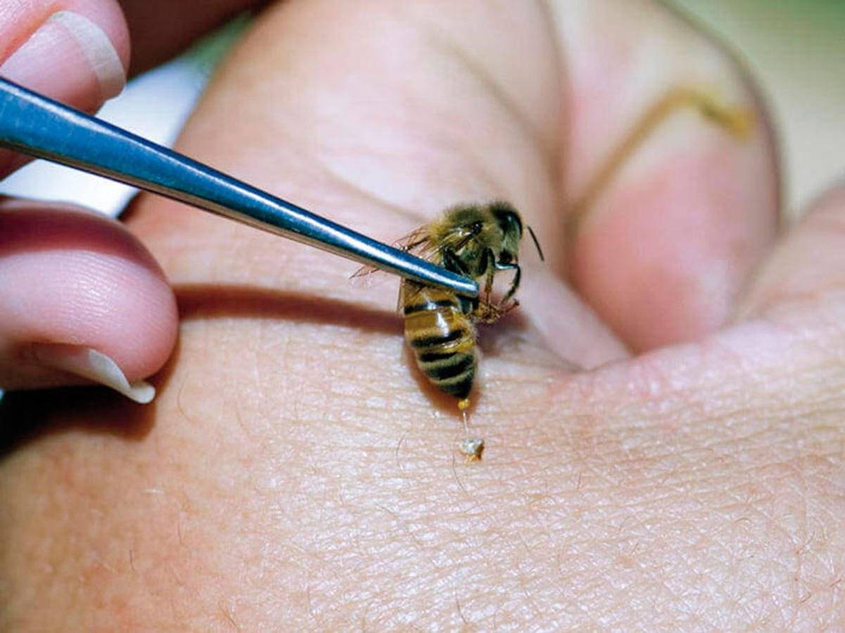 Если тебя укусила оса нужно. Шмель пчела Оса Шершень укусы. Пчелиный яд апитерапия.