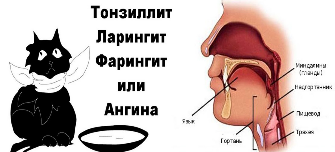 Я разрешу тебе глотку. Тонзиллиты фарингиты ларингиты. Боль в горле при глотании.