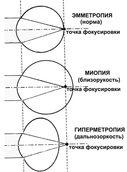 Трахается в очках