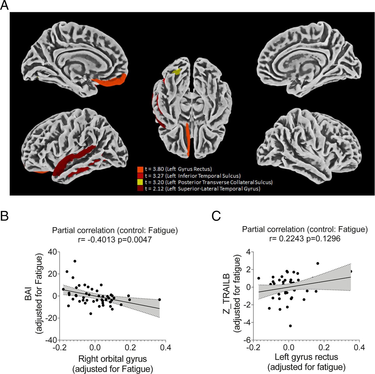    Изменение толщины коры у инфицированных SARS-CoV-210.1073/pnas.2200960119