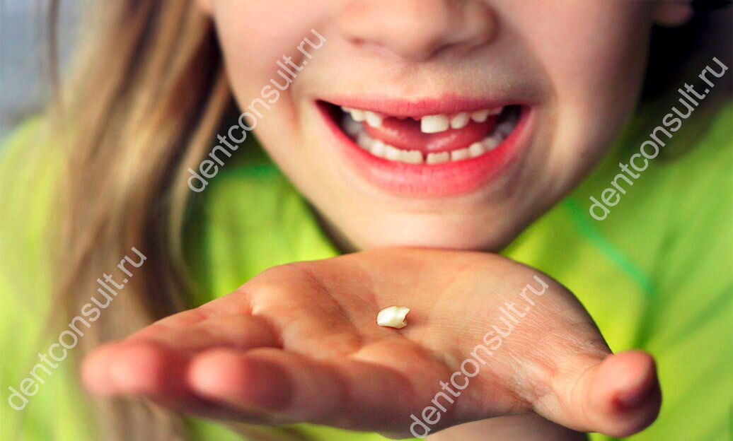 Когда происходит смена молочного прикуса на постоянный. Фото: dentconsult.ru