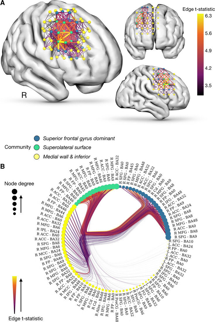   Lisa Cipolotti et al. / Brain, 2022