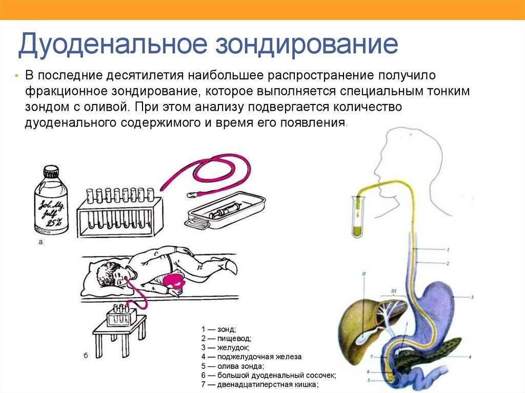 Дуоденальное зондирование презентация