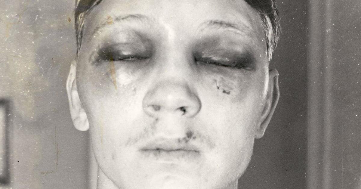 Билл Коллинз после боя