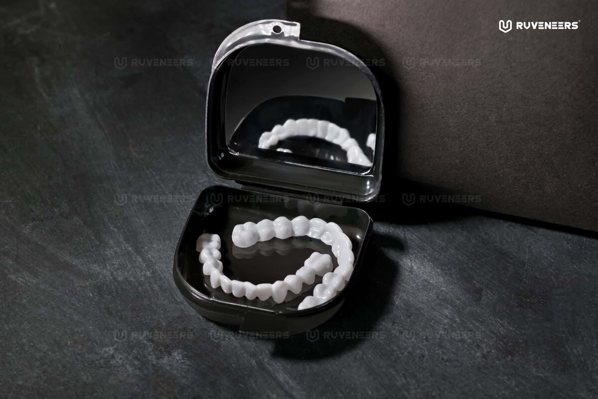 Виниры поставляются вместе с удобный боксом для хранения