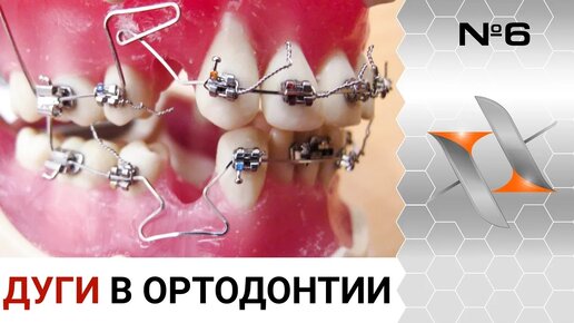 Дуги в брекет-системе. (ортодонтия, мини-лекция)