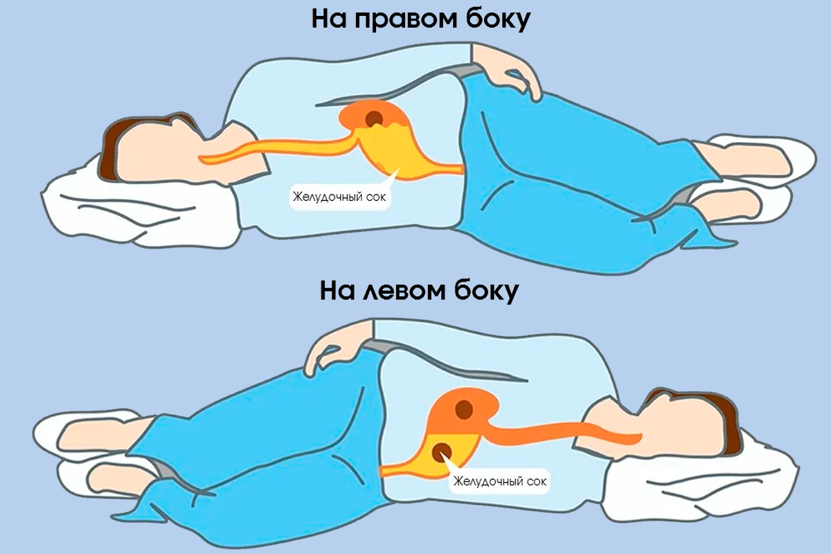 Спать на спине или на животе. На каком боку лучше спать. Спать на левом боку. На каком боку лучше спать при изжоге. На кокому боку спать.