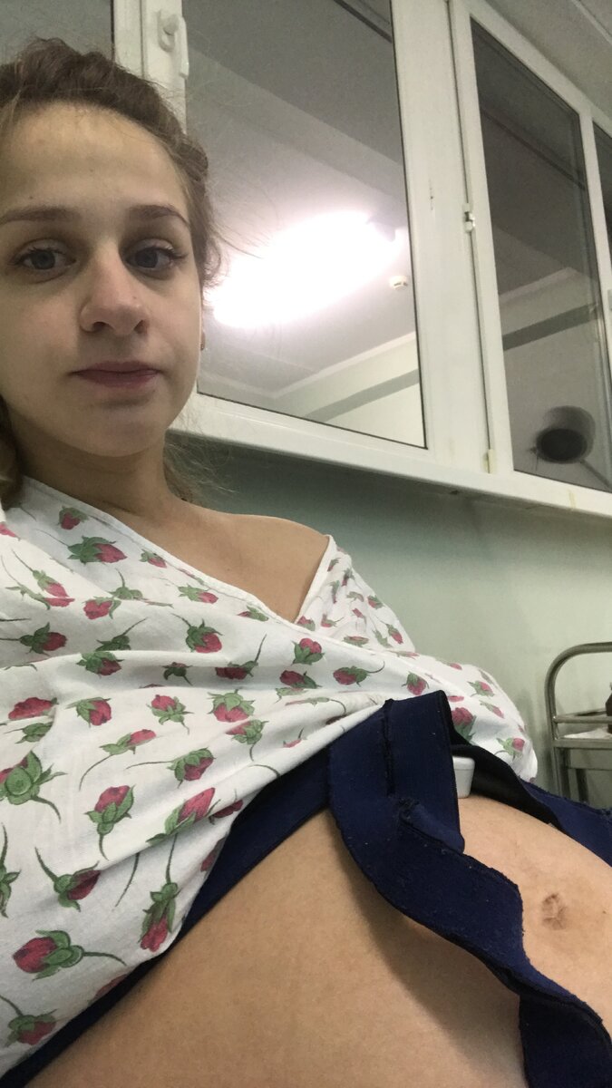 2018 год, день Х)