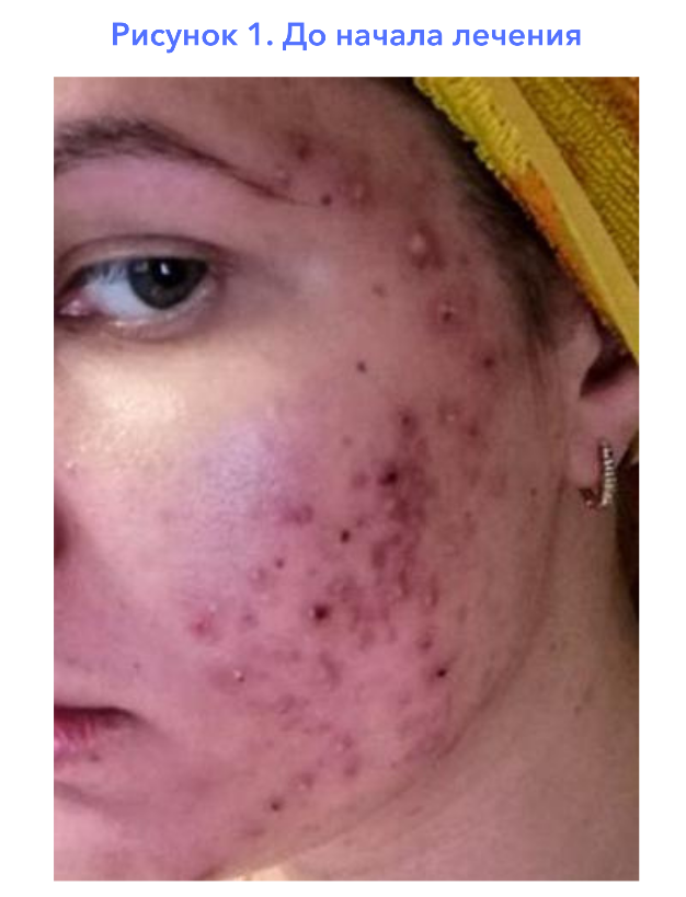 Рис.1. До начала лечения