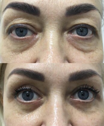 Операция прошла в Solei Clinic
