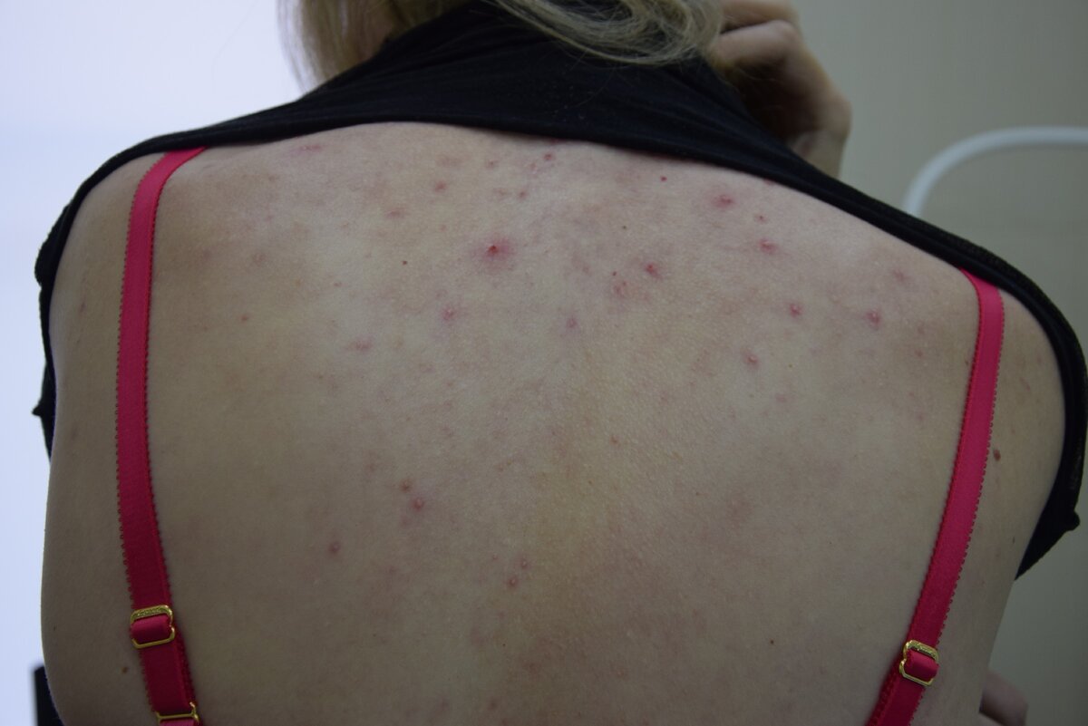 Взято из яндекс картинок. Статья из внешнего источника.